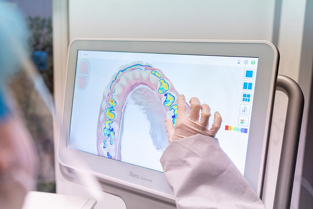 Qué causa el desgaste dental